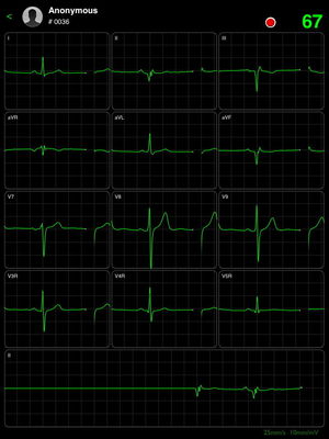 ICV200 IPad ECG Machine Smart Wireless Bluetooth White Recorder