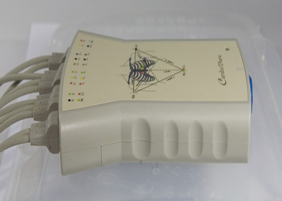 Treadmill Stress Test ECG , ST / HR ECG For Electrocardiography Test
