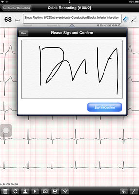 Wifi portable digital home iPad ECG machine , Heart rate monitor