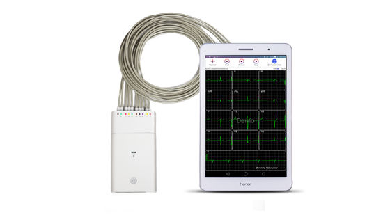 Beyaz EKG Sinyal Kaydedici Andriod Sistemi Bluetooth EKG Makinesi